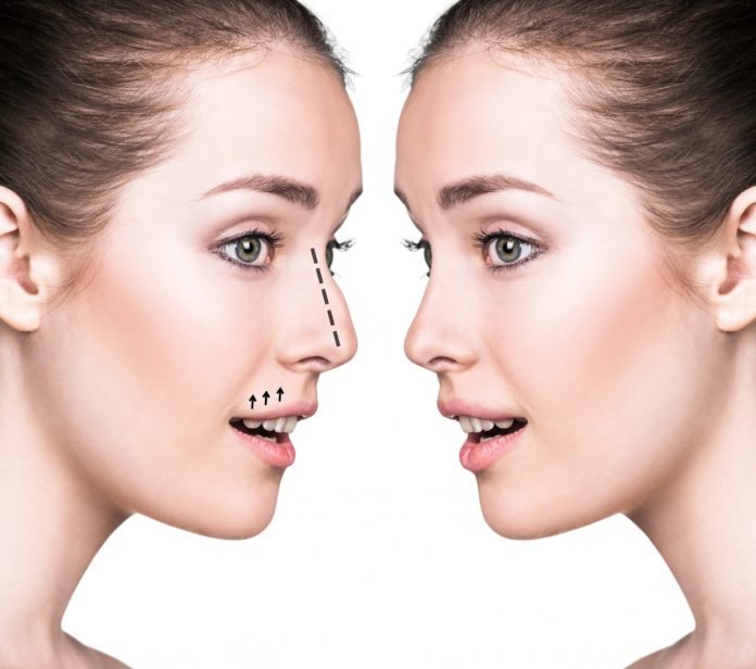 Average Cost of Rhinoplasty: What To Expect