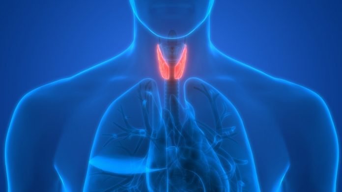 Hypothyroidism