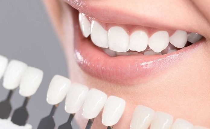 Guide to teeth whitening strips