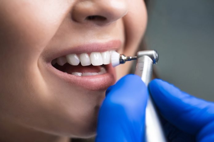 Here's Everything You Need To Know About Teeth Cleaning