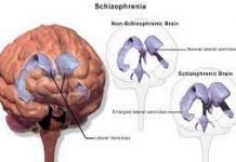 How to Identify Medication How to Identify Medication