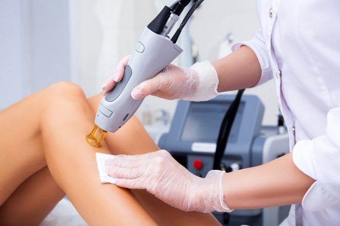 Steps To Take Before Preparing For Laser Hair Removal