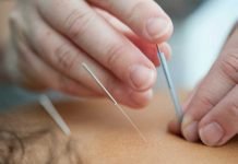 Dry Needling Vs. Acupuncture: The Difference Dry Needling Vs. Acupuncture: The Difference