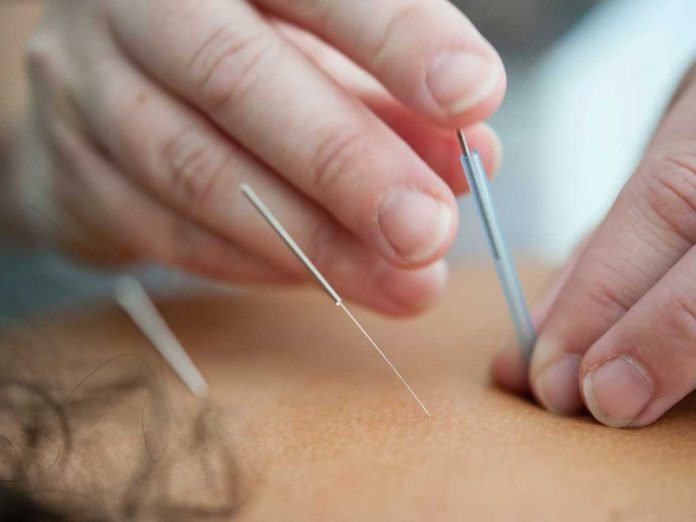 Dry Needling Vs. Acupuncture: The Difference