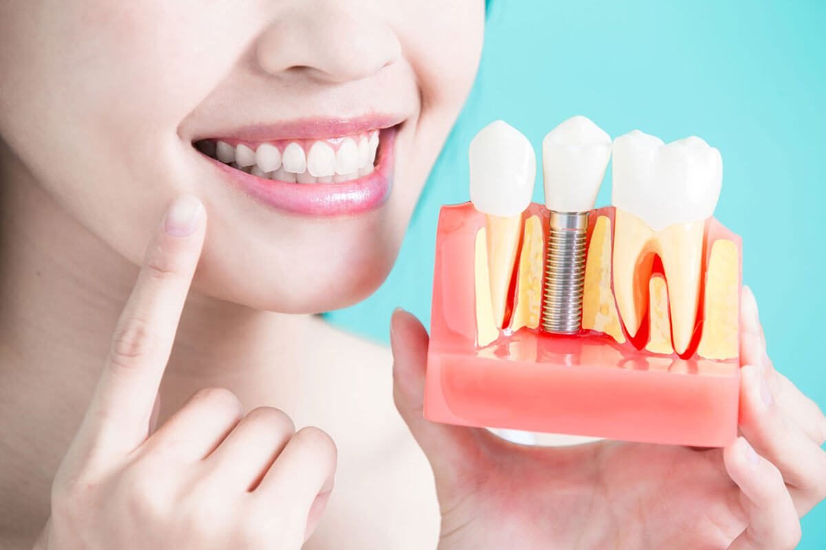 Are There Long-Term Teeth Replacement Options?