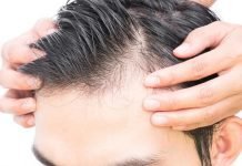 Losing Your Hair? Here’s What Could be Going Wrong and How to Stop It Hair