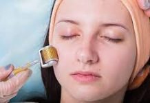 Reasons Microneedling Is The Best Thing To Happen To Your Skin Microneedling