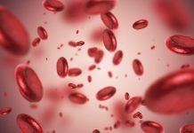 Everything You Need To Know About Iron Deficiency Anemia Iron Deficiency Anemia