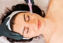 Achieve Youthful Skin with Vivace Microneedle RF: A Revolutionary Skincare Treatment Vivace Microneedle RF