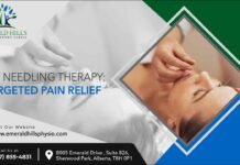 Dry Needling Therapy: Targeted Pain Relief Dry Needling Therapy
