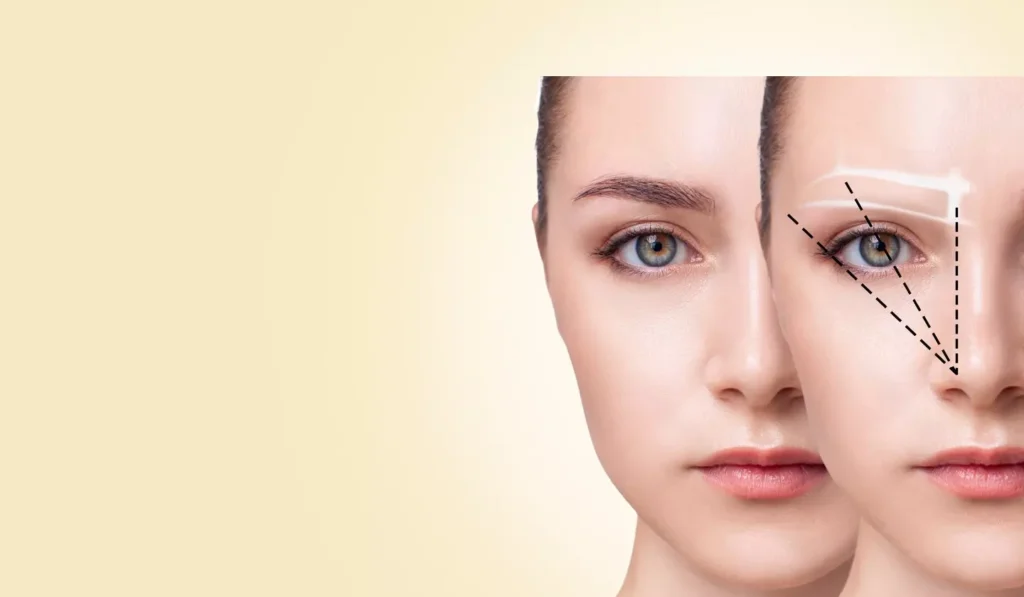 Revitalize Your Appearance with Expert Eye Bag Treatments