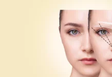 Revitalize Your Appearance with Expert Eye Bag Treatments Eye Bag Treatments