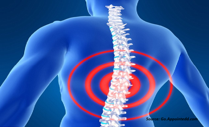 Spinal Implants