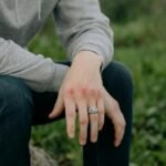 Personal Injury Claims