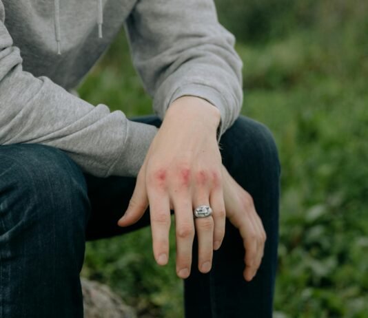 Navigating Personal Injury Claims: A Comprehensive Guide Personal Injury Claims