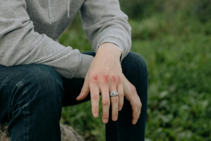 Personal Injury Claims