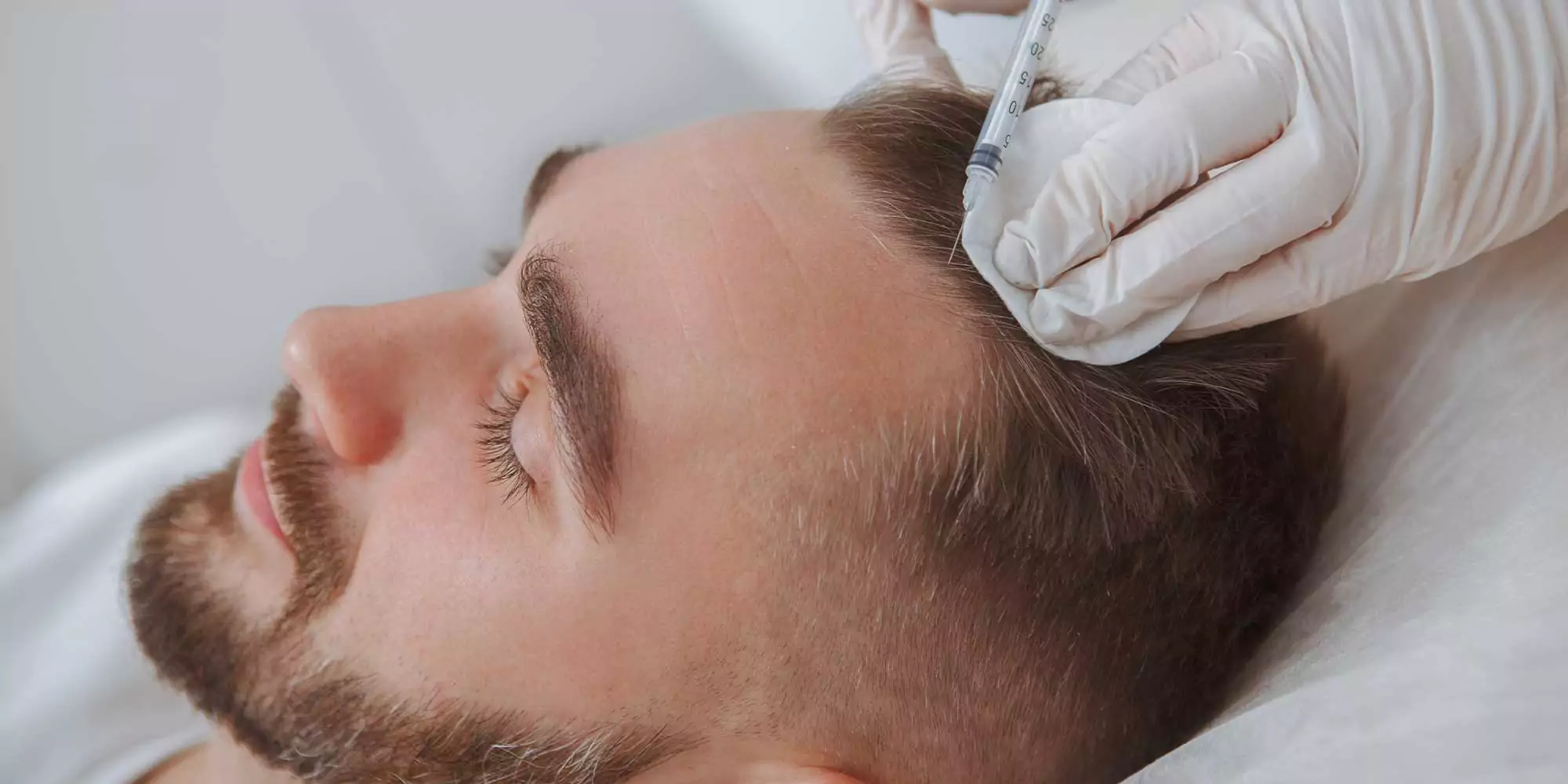 HAIR TRANSPLANT Overview and Definition 
